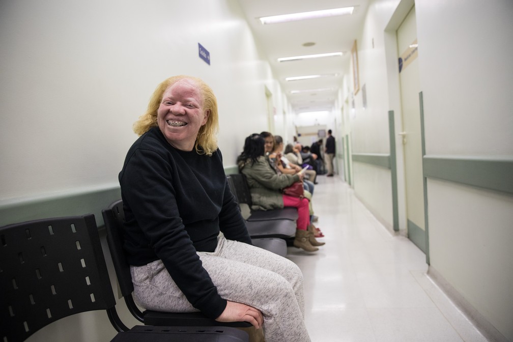 Aparecida de Souza, uma das pacientes do Pró-Albino, aguarda por consulta (Foto: Fabio Tito/G1)