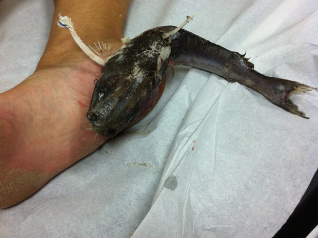 Mulher foi anestesiada para retirar o peixe (Foto: Arquivo Pessoal/ Octavia Leme)