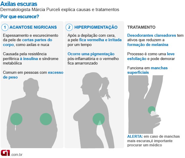 Bem Estar - Infográfico sobre axilas escuras (Foto: Arte/G1)