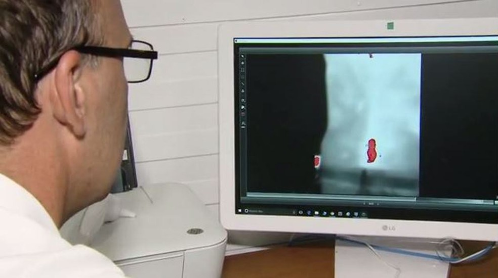 Equipamento mapeia a dor no corpo do paciente  (Foto: Reprodução/RBS TV)