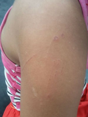 Menina de cinco anos foi encontrada com arranhões e hematomas (Foto: Isabelli Vitória / Medeiros Dia Dia)