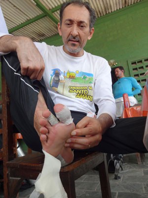 Terceiro dia de caminhada já é sentido pelo pés (Foto: Tuca Paes de Andrade/Acervo Pessoal)