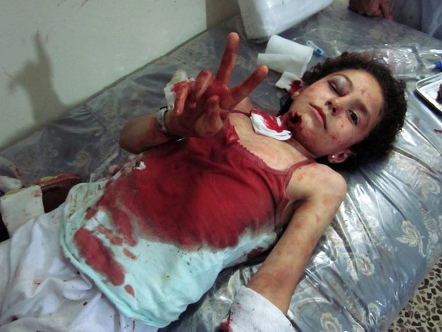 Menina síria ferida em confrontos faz sinal da vitória em Qusayr, a 15 quilômetros de Homs, em foto divulgada nesta segunda-feira (23) pela oposição (Foto: AFP) Menina síria ferida em confrontos faz sinal da vitória em Qusayr, a 15 quilômetros de Homs, em foto divulgada nesta segunda-feira (23) pela oposição (Foto: AFP)