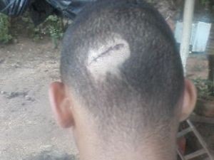 Jovem diz ter sido agredido em Sete Barras, SP (Foto: Ivani Ramos / Arquivo Pessoal)