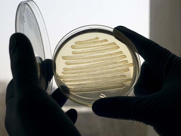 Biodiesel de 'Escherichia coli' foi produzido em laboratório; aumentar a produção é um desafio (Foto: Marian Littlejohn/Divulgação)