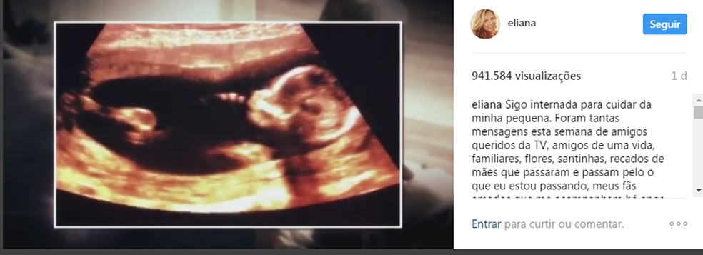 Mensagem de Eliana no Instagram sobre seu problema na gestação (Foto: Reprodução/Instagram/Eliana)