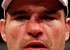 Com nariz quebrado, 
Shogun deve passar por cirurgia na quarta-feira (Getty Images)