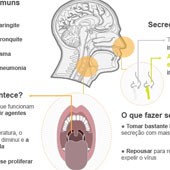 Mudança no clima  aumenta risco de gripe (Mudança no clima  aumenta risco de gripe (Compare o novo Corolla com o anterior (Editoria de arte/G1)))