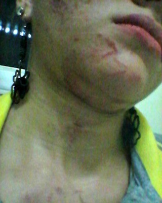 Cobradora foi agredida com arranhões, puxões de cabelo e tapas (Foto: Erica da Costa/Arquivo Pessoal)