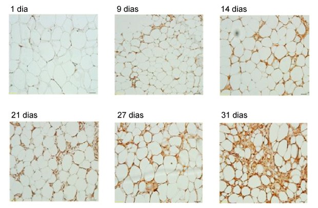 Infiltração de gordura marrom entre células adiposas brancas em vítima de queimadura. (Foto: Sidossis et. al/"Cell Metabolism")