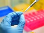 Teste para detectar zika no sêmen já é realizado (Divulgação/Instituto Oswaldo Cruz)
