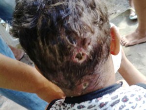 Criança tinha inúmeras feridas na cabeça e reclamava de dores (Foto: Divulgação / Conselho Tutelar)