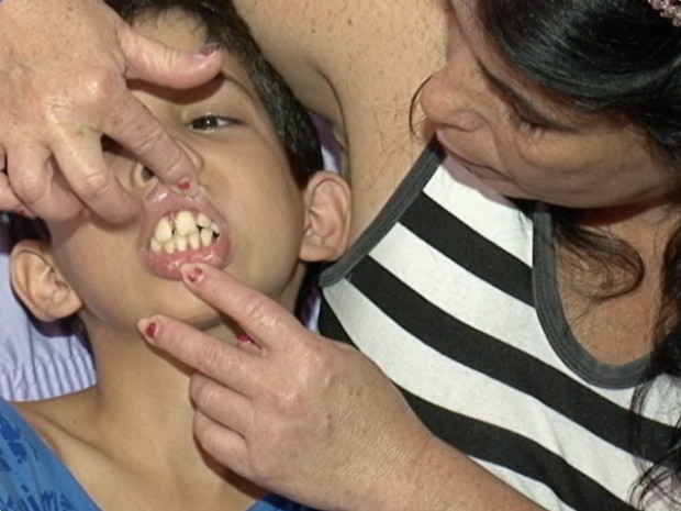 Menino não consegue abrir a boca e espera cirurgia há um ano e meio, no Espírito Santo (Foto: Reprodução/TV Gazeta)