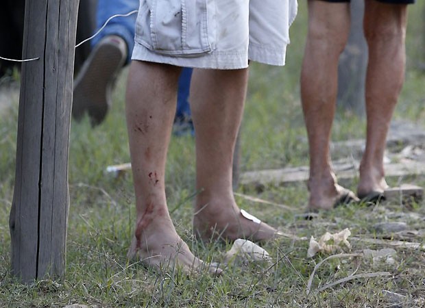 A perna de Marcello Antony (Foto: AG News)