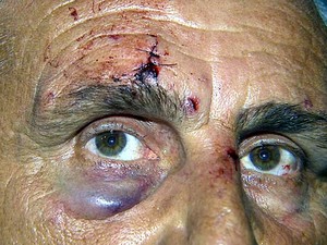 O motorista Josimar da Silva que foi agredido por assaltantes em Hortolândia (Foto: Reprodução EPTV)