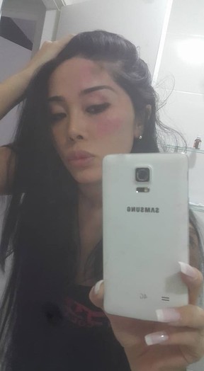 Natalia Inoue diz ter sido agredida (Foto: Facebook / Reprodução)