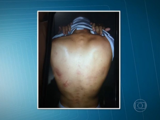 Lesões nas costas de suspeito de roubo na Zona Leste de São Paulo (Foto: Reprodução/TV Globo)