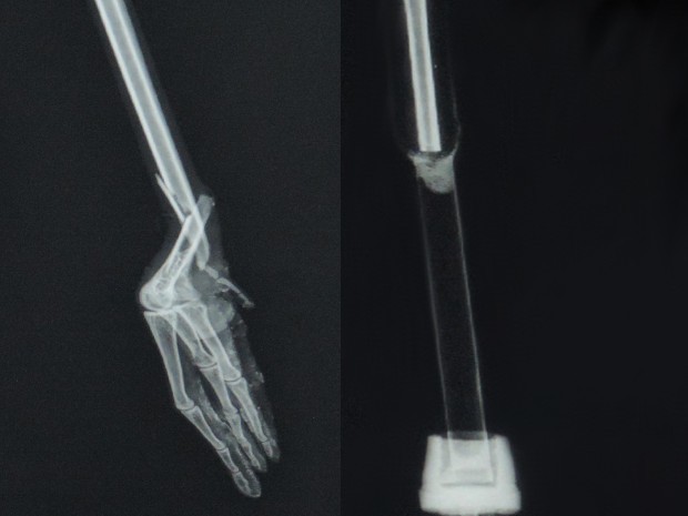 Raio-x mostra pata da ave com fratura e após amputação e colocação da prótese (Foto: Tássia Lima / G1)