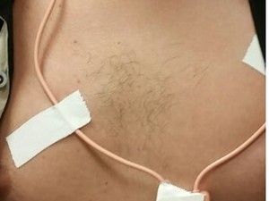 Candidato de 34 anos é preso em flagrante por usar ponto eletrônico durante Enem em Fortaleza (Foto: Divulgação/Polícia Federal)