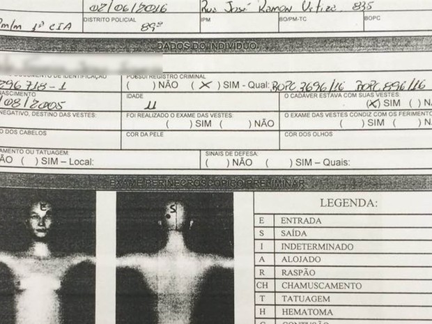 Desenho mostra local da cabeça onde tiro atingiu menino de 10 anos (Foto: Reprodução) Desenho mostra local da cabeça onde tiro atingiu menino de 10 anos (Foto: Reprodução)