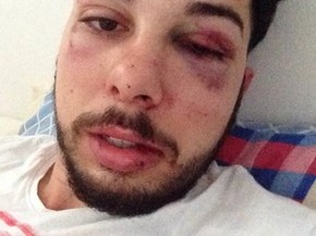 Segundo Luis Cláudio Prado, os ferimentos no rosto foram provocados por policiais (Foto: Arquivo Pessoal)