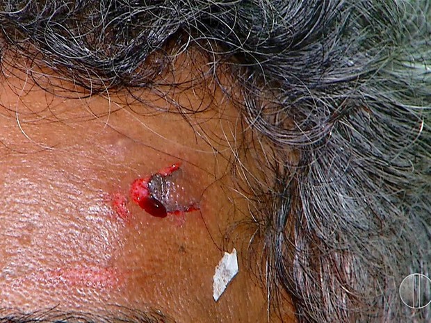 Motorista foi agredido com uma coronhada na testa (Foto: Reprodução/ Inter TV Cabugi)