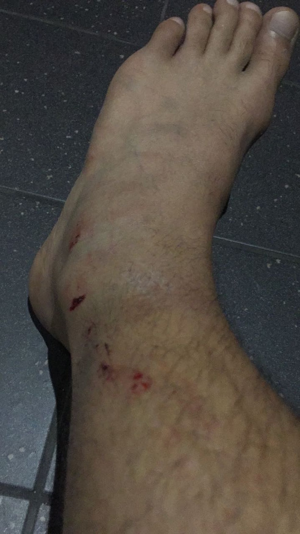 Victor Bastos mostra ferimentos sofrifos durante incidente em Turim (Foto: Victor Bastos)