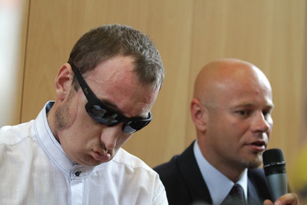 Primeiro homem a receber transplante de face na Polônia tem alta. (Foto: AFP Photo/Bartek Wrzesniowski)