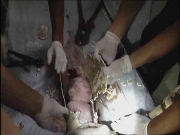Recém-nascido havia sido jogado no vaso sanitário (Foto: Reuters)