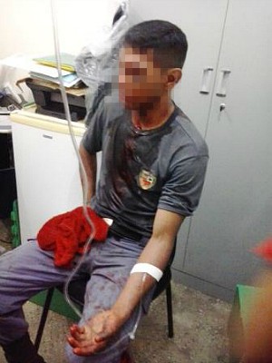 Policial teria sido agredido com facão e, por isso, disparou contra adolescente em Manaus (Foto: Divulgação/PM-AM)