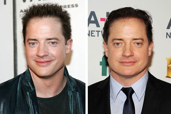 Brendan Fraser (Foto: Getty Images)