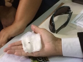 Estilhaço de bala feriu a cantora no braço (Foto: Pedro Mesquita/G1)