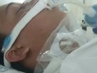 Jovem fica 8 dias em coma após ser atingido por linha com cerol em MT