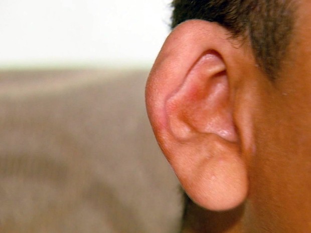 Mutirão vai baratear cirurgias para correção de orelha de abano no Sul de Minas (Foto: Reprodução EPTV)