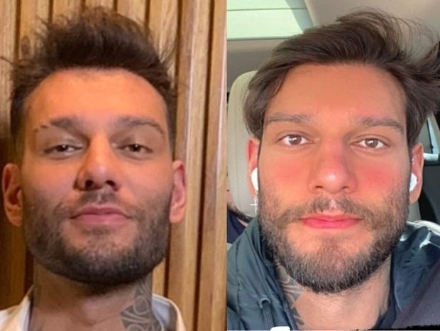 Antes e depois de Lucas Lucco (Foto: Reprodução/Instagram)