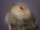 Bill Murray é fotografado com a cabeça sangrando em première
