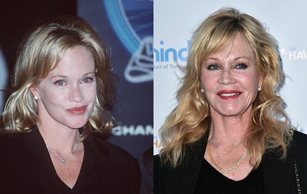 Melanie Griffith em 1998 e em 2016 (Foto: Getty Images)