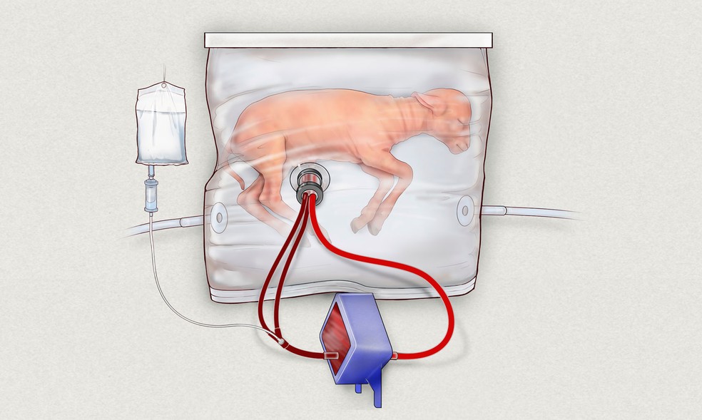  Ilustração mostra sistema que imita útero que poderá ser usado, no futuro, em casos de bebês prematuros; em testes, cordeiros cresceram por quatro semanas dentro do 