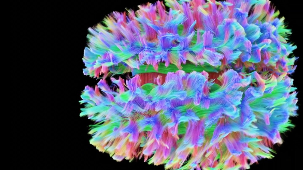 Cientistas criam imagem detalhada do cérebro  (Foto: BBC)