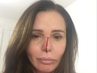 Cristina Mortágua mostra na web foto com rosto sangrando