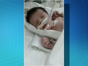 Bebê aguarda por cirurgia que não é feita no Tocantins (Foto: Reprodução/TV Anhanguera)