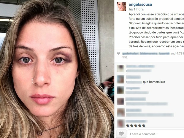 G1 Angela Sousa Desabafa Em Rede Social Sobre Agress 227 O