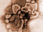 Adolescente morre com suspeita de H1N1 (reprodução)