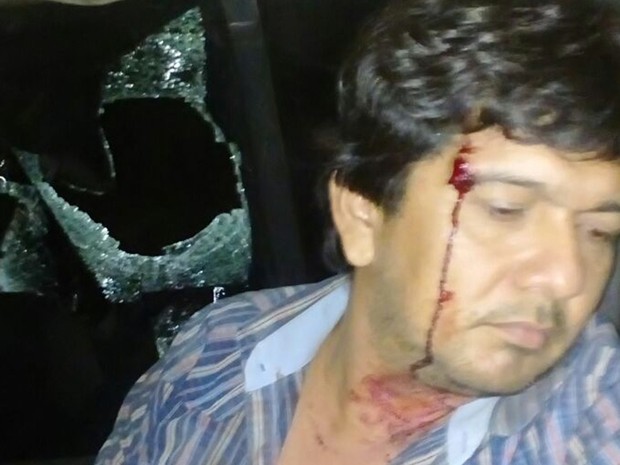 Fiscal foi ferido por estilhaços de vidro na cabeça (Foto: Polícia Civil de óbidos/Divulgação)