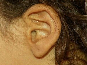 Criança está há três dias com besouro no ouvido, em Anápolis (Foto: Reprodução/TV Anhanguera)
