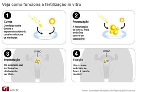 Entenda como funciona afertilização in vitro (Foto: Editoria de Arte/G1) Entenda como funciona afertilização in vitro (Foto: Editoria de Arte/G1)
