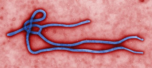 O vírus ebola (Foto: AP Photo/CDC)