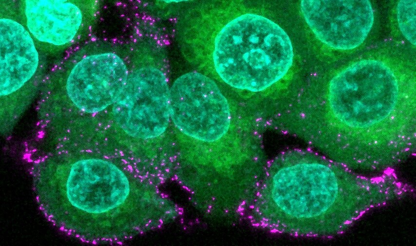 Imagem de células epiteliais humanas (verde) incubadas com partículas sintéticas do vírus Sars-CoV-2 (magenta) (Foto: Oskar Staufer/MPI for Medical Research, Germany)