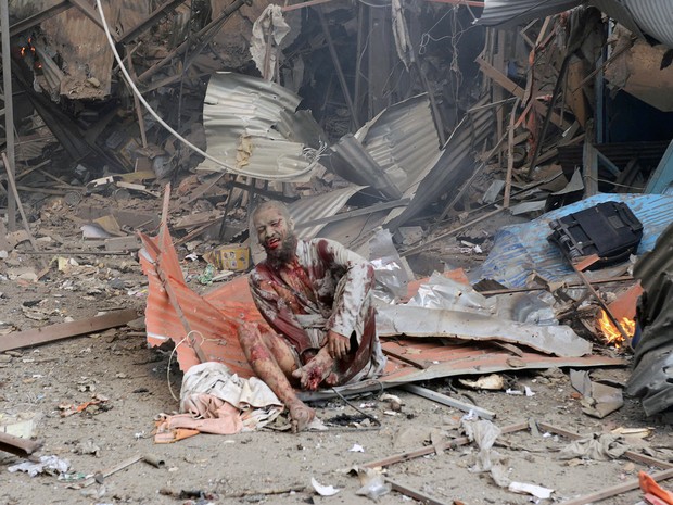 Homem ferido após explosão de bomba no Paquistão. (Foto: Hasham Ahmed/AFP)