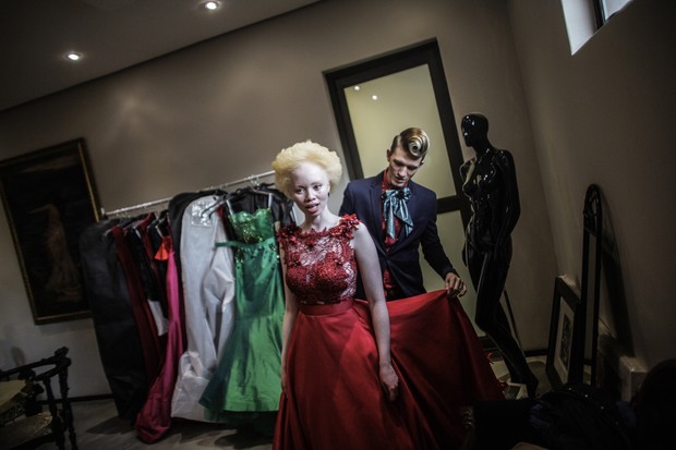 Thando Hopa, modelo albina sul-africana (Foto: AFP)